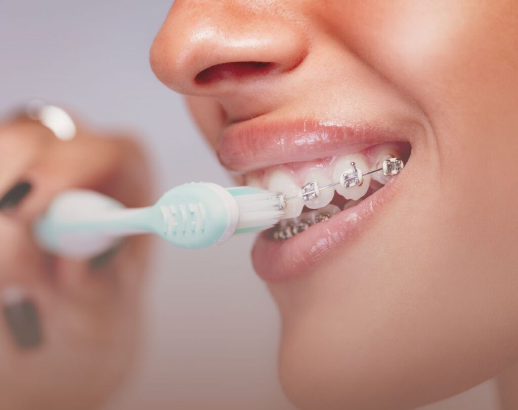 imagem de mulher com aparelho ortodontico a lavar os dentes