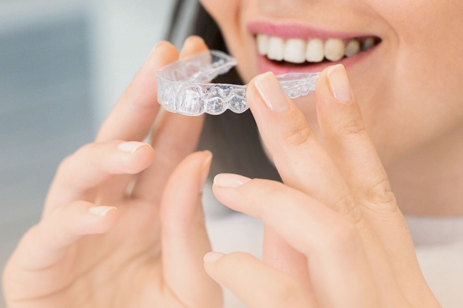 Benefícios do uso do Invisalign